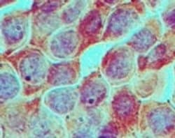 Invitrogen RUVBL1 Polyclonal Antibody 100 &mu;g; Unconjugated:Antibodies,