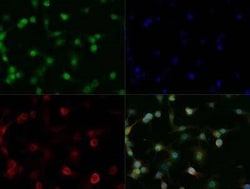 Invitrogen OLIG2 Polyclonal Antibody 100 &mu;g; Unconjugated:Antibodies,