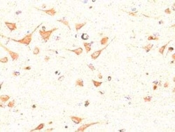 Invitrogen OLIG2 Polyclonal Antibody 100 &mu;g; Unconjugated:Antibodies,