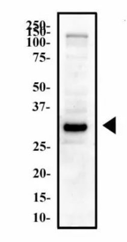 Invitrogen OLIG2 Polyclonal Antibody 100 &mu;g; Unconjugated:Antibodies,