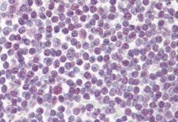 Invitrogen DDX18 Polyclonal Antibody 100 &mu;g; Unconjugated:Antibodies,