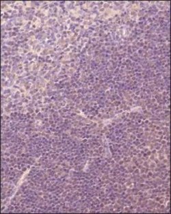 Invitrogen TRIF Polyclonal Antibody 100 μg; Unconjugated:Antibodies,