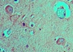 FABP7 Polyclonal Antibody, Invitrogen 100 &mu;g; Unconjugated:Antibodies,