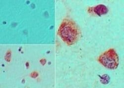 Invitrogen S1P1 Polyclonal Antibody 100 μg; Unconjugated:Antibodies,