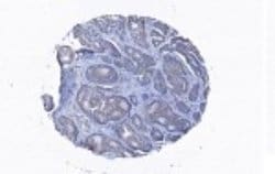 Invitrogen Coronin 3 Polyclonal Antibody 100 &mu;g; Unconjugated:Antibodies,