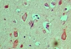 CACTIN Polyclonal Antibody:Antibodies, Polyclonal