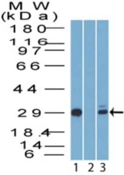 Invitrogen 14-3-3 sigma Polyclonal Antibody 100 &mu;g | Buy Online | Invitrogen&trade; | Fisher Scientific