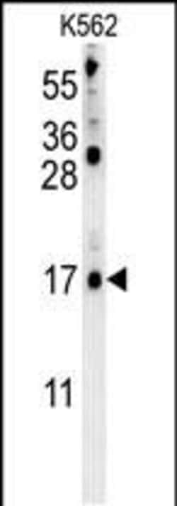Invitrogen LCE2B Polyclonal Antibody 400 &mu;L; Unconjugated:Antibodies,