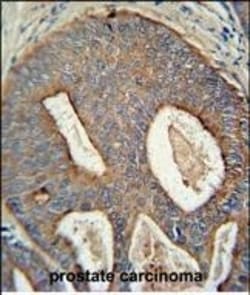 Invitrogen POTEB Polyclonal Antibody 400 &mu;L; Unconjugated:Antibodies,