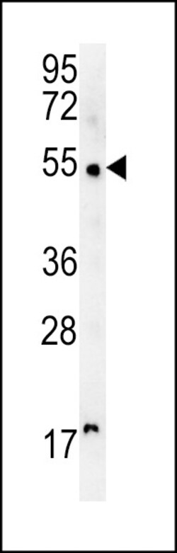 Invitrogen SCARA5 Polyclonal Antibody 400 μL; Unconjugated:Antibodies,