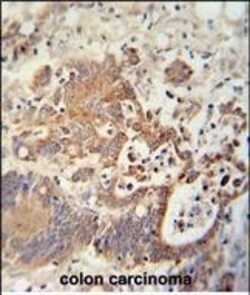 Invitrogen CHCHD2 Polyclonal Antibody 400 &mu;L; Unconjugated:Antibodies,