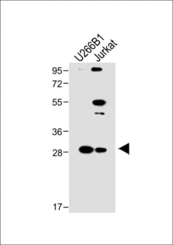 Invitrogen LAPTM5 Polyclonal Antibody 400 &mu;L; Unconjugated:Antibodies,