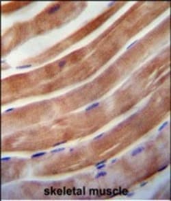 Invitrogen KEAP1 Polyclonal Antibody 400 &mu;L | Buy Online | Invitrogen&trade; | Fisher Scientific