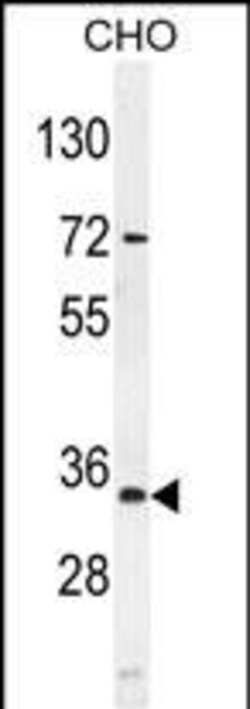 Invitrogen AKIP1 Polyclonal Antibody 400 μL; Unconjugated:Antibodies,