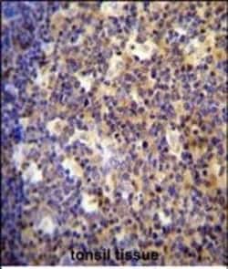 Invitrogen ALOX12B Polyclonal Antibody 400 &mu;L; Unconjugated:Antibodies,