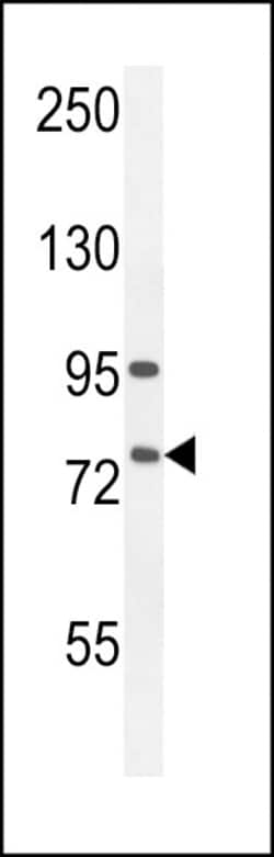 Invitrogen ALOX12B Polyclonal Antibody 400 &mu;L; Unconjugated:Antibodies,