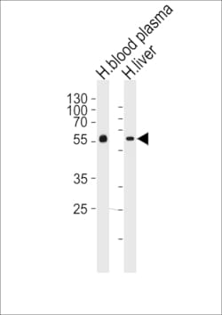 Invitrogen Fetuin A Polyclonal Antibody 400 μL; Unconjugated:Antibodies,