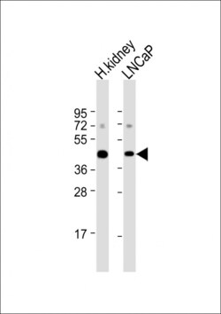 Invitrogen AMACR Polyclonal Antibody 400 &mu;L | Buy Online | Invitrogen&trade; | Fisher Scientific
