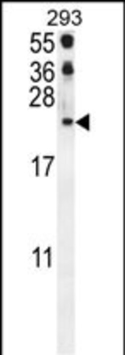 Invitrogen CCL21 Polyclonal Antibody 400 &mu;L; Unconjugated:Antibodies,