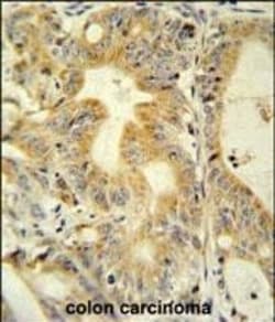 Invitrogen DcR3 Polyclonal Antibody 400 &mu;L; Unconjugated:Antibodies,