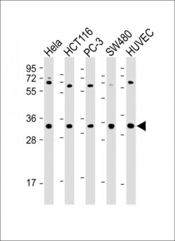 Invitrogen DcR3 Polyclonal Antibody 400 &mu;L; Unconjugated:Antibodies,