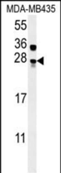 Invitrogen MUTED Polyclonal Antibody 400 &mu;L; Unconjugated:Antibodies,