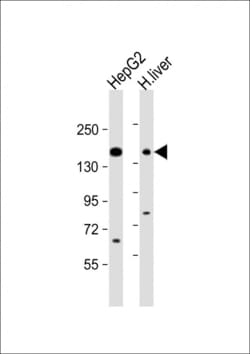 Invitrogen MRP3 Polyclonal Antibody 400 &mu;L | Buy Online | Invitrogen&trade; | Fisher Scientific