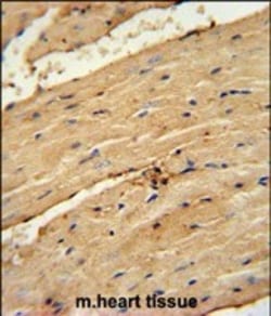 Invitrogen&trade;&nbsp;TIMP4 Polyclonal Antibody