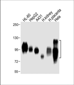 Invitrogen CD98 Polyclonal Antibody 400 &mu;L; Unconjugated:Antibodies,