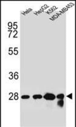Invitrogen CHPT1 Polyclonal Antibody 400 &mu;L; Unconjugated:Antibodies,