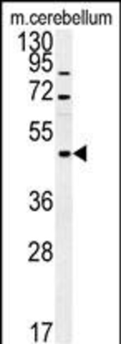 Invitrogen FUS Polyclonal Antibody 400 &mu;L; Unconjugated:Antibodies,