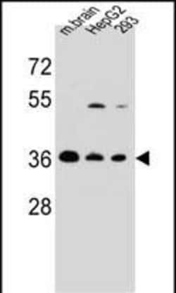 Invitrogen FBXO2 Polyclonal Antibody 400 &mu;L; Unconjugated:Antibodies,