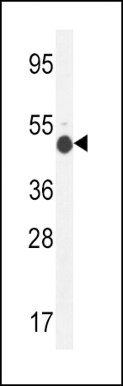 Invitrogen GCNT2 Polyclonal Antibody 400 &mu;L | Buy Online | Invitrogen&trade; | Fisher Scientific