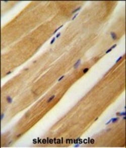 Invitrogen MLXIP Polyclonal Antibody 400 &mu;L; Unconjugated:Antibodies,