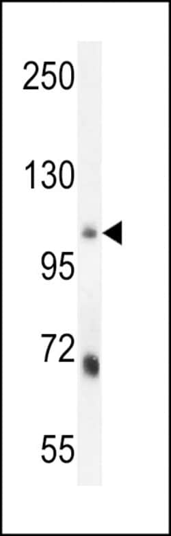 Invitrogen MLXIP Polyclonal Antibody 400 &mu;L; Unconjugated:Antibodies,