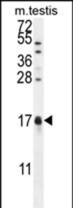 Invitrogen CAMK2N1 Polyclonal Antibody 400 μL; Unconjugated:Antibodies,