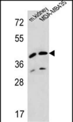 Invitrogen L2HGDH Polyclonal Antibody 400 &mu;L; Unconjugated:Antibodies,