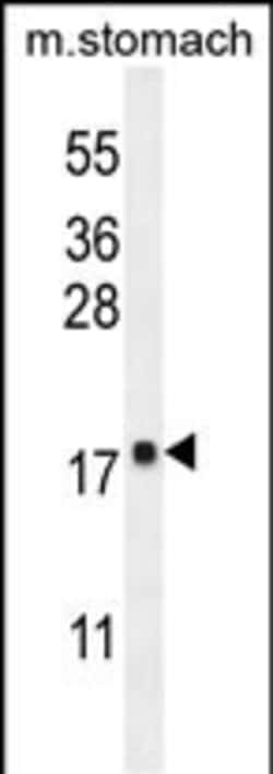 Invitrogen DYNLRB2 Polyclonal Antibody 400 &mu;L; Unconjugated:Antibodies,