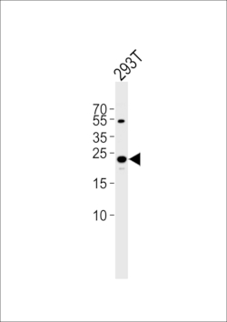 Invitrogen TFAM Polyclonal Antibody 400 &mu;L; Unconjugated:Antibodies,