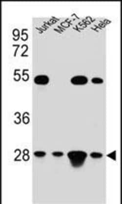 Invitrogen TFAM Polyclonal Antibody 400 &mu;L; Unconjugated:Antibodies,