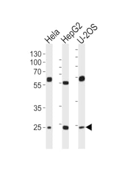 Invitrogen TFAM Polyclonal Antibody 400 &mu;L; Unconjugated:Antibodies,