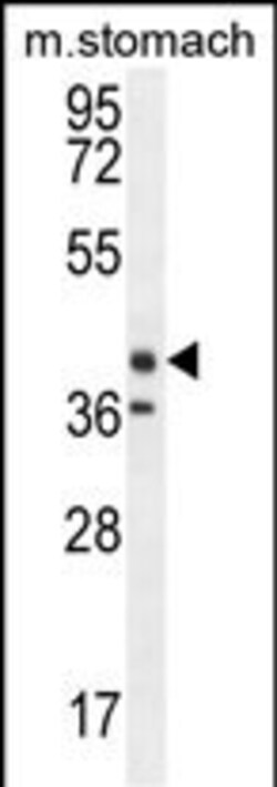 Invitrogen TECTB Polyclonal Antibody 400 &mu;L; Unconjugated:Antibodies,
