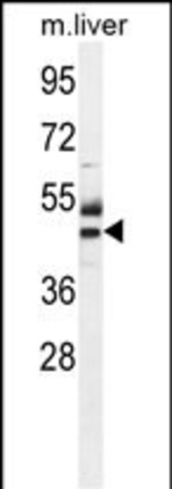 Invitrogen CTU1 Polyclonal Antibody 400 &mu;L | Buy Online | Invitrogen&trade; | Fisher Scientific
