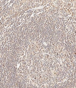 Invitrogen CEPT1 Polyclonal Antibody 400 &mu;L | Buy Online | Invitrogen&trade; | Fisher Scientific