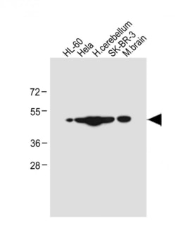 Invitrogen CEPT1 Polyclonal Antibody 400 &mu;L | Buy Online | Invitrogen&trade; | Fisher Scientific