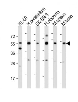 Invitrogen CEPT1 Polyclonal Antibody 400 &mu;L | Buy Online | Invitrogen&trade; | Fisher Scientific