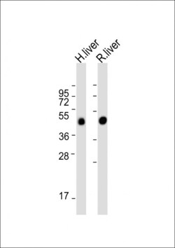 Invitrogen METTL4 Polyclonal Antibody 200 &mu;L; Unconjugated:Antibodies,