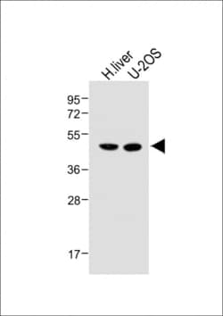 Invitrogen METTL4 Polyclonal Antibody 200 &mu;L; Unconjugated:Antibodies,