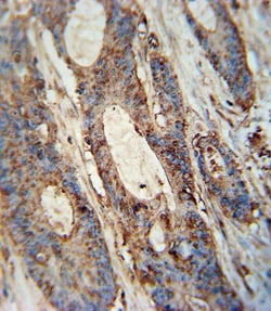 Invitrogen FAM46A Polyclonal Antibody 400 &mu;L; Unconjugated:Antibodies,