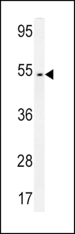 Invitrogen FAM46A Polyclonal Antibody 400 &mu;L; Unconjugated:Antibodies,
